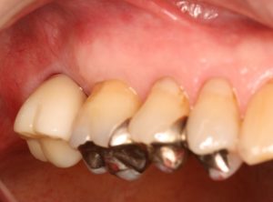 %e7%ab%9c%e7%94%b0%ef%bc%98%e3%80%80%e8%a2%ab%e3%81%9b%e7%89%a9%e8%a3%85%e7%9d%80%e5%be%8c%e3%80%80